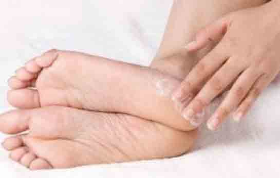 Ayak Tabanı Şişmesi Belirtileri ve Tedavisi