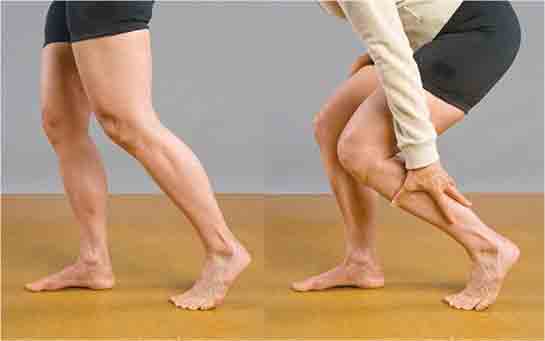 Ayakta Damar Şişmesi Belirtileri ve Tedavisi