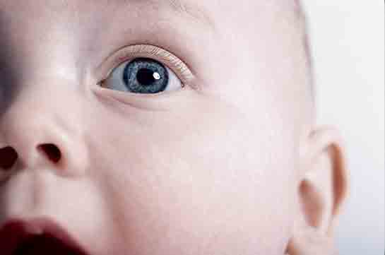 Bebeklerde Göz Şişmesi